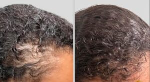 Batana Natural Hair Growth Oil |🎁 BUY 1 GET 1 FREE photo review