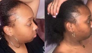 Batana Natural Hair Growth Oil |🎁 BUY 1 GET 1 FREE photo review