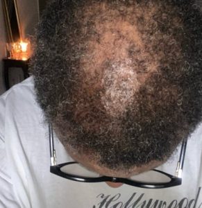 100% Pure Batana Oil 4 oz/ 118 Ml ( cream form ) – 𝗼𝗿𝗶𝗴𝗶𝗻𝗮𝗹 𝗹𝗮𝗯-𝘁𝗲𝘀𝘁𝗲𝗱 ✅ photo review